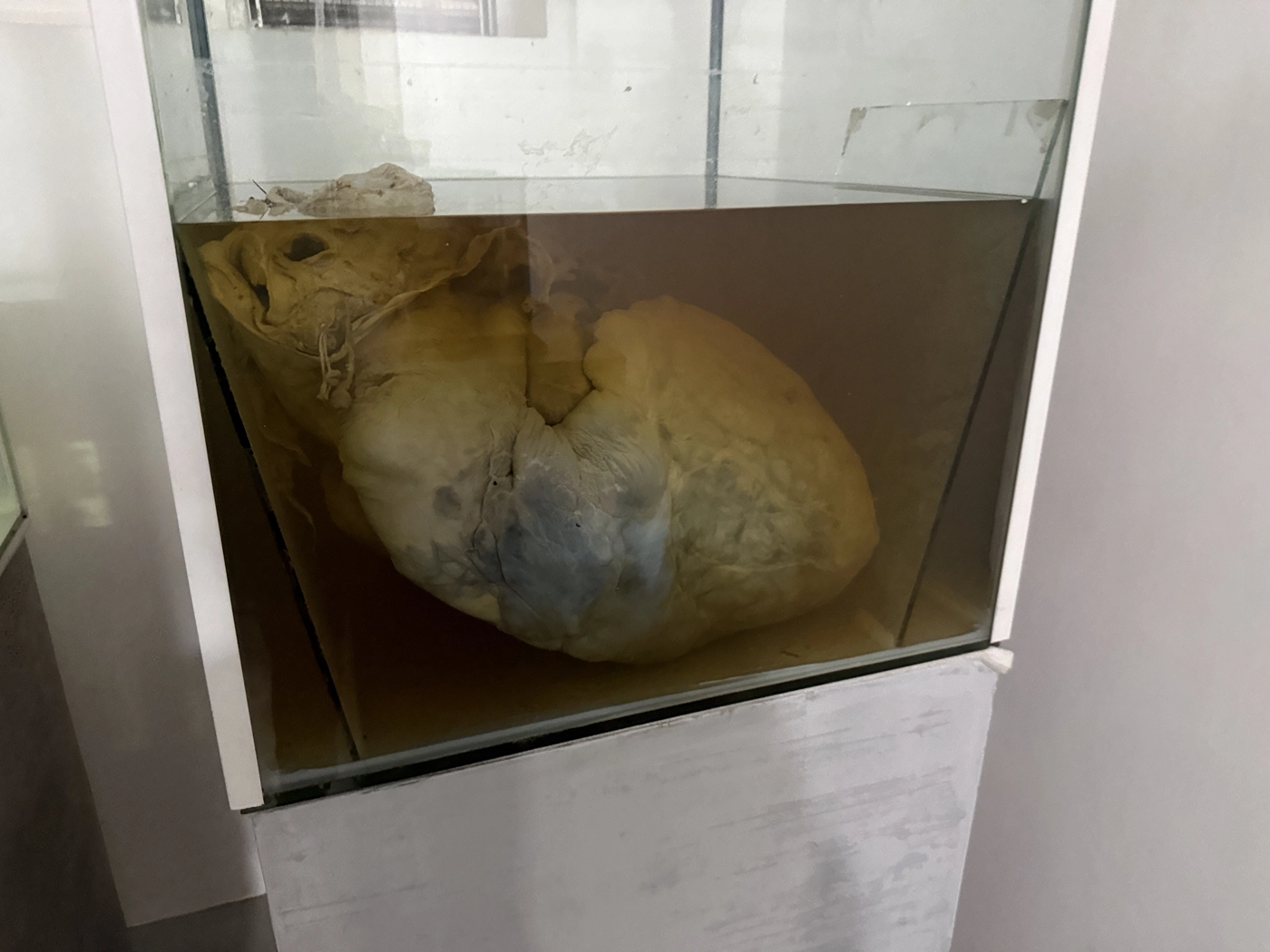 Elephant heart preserved in a glass tank